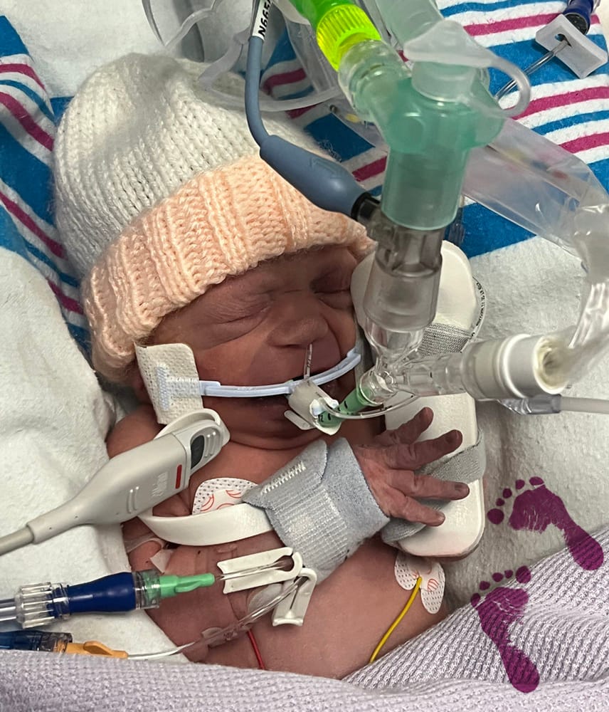 A baby wrapped in blankets receiving specialist medical care