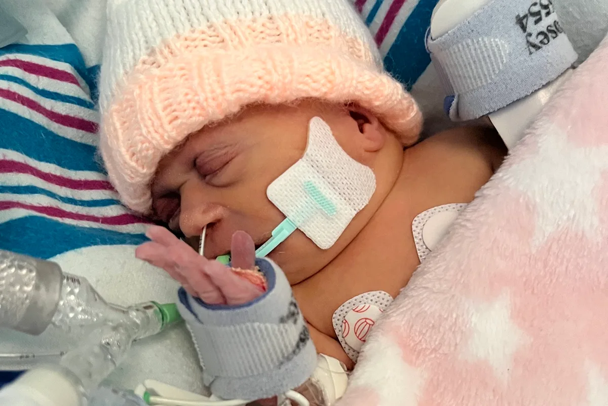 A baby wrapped up in blankets with lots of tubes and medical assistance on her
