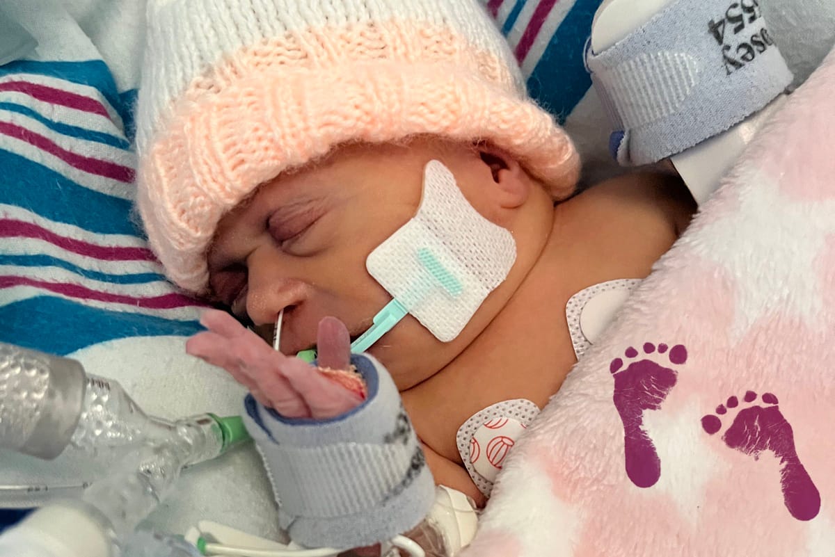 A baby wrapped up in blankets with lots of tubes and medical assistance on her