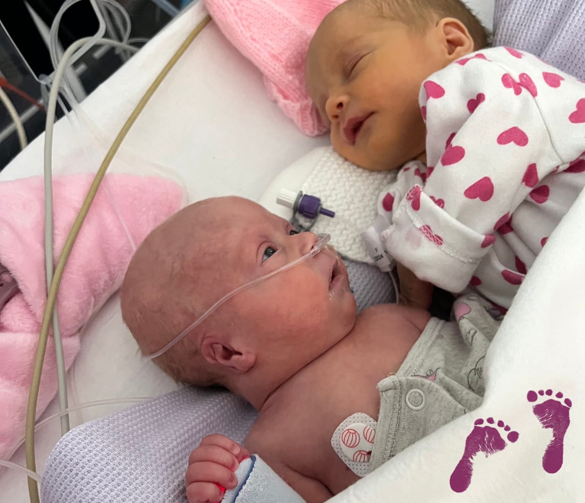 Two babies side by side in a bed, one with medical tubes and wires
